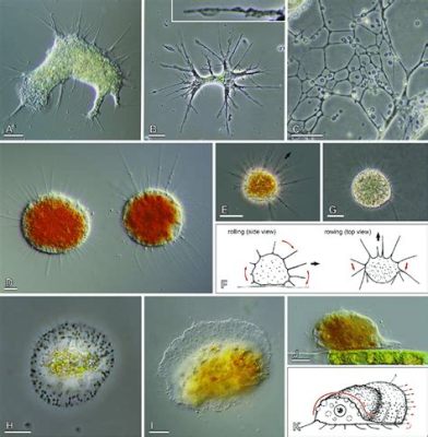  Leptophrys! An Amoeboid Mastermind Disguised as a Single Cell