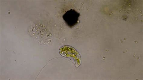  Rhizamoeba!  A Tiny Ciliate That Thrives by Ingesting Bacteria Like It's Going Out of Style